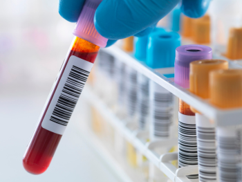 gloved hand holding a vial of blood